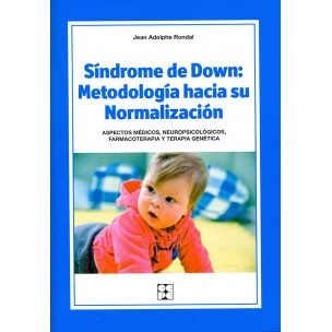 Síndrome de Down: Metodología hacia su normalización